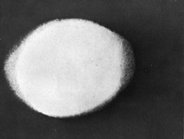 Photo d'une foudre globulaire de 30 cm de diamètre